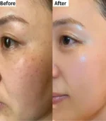 Brightening Cream after Using results