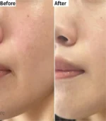 Moisturizer Results