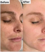 Sun block results