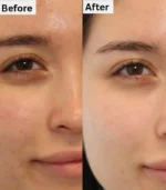 Face Wash Results